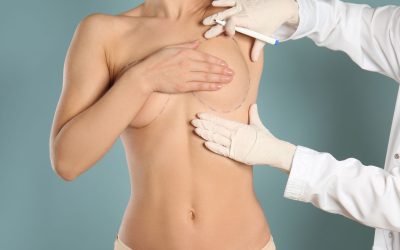 Breast